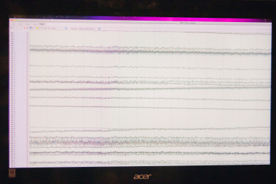 Record of an EEG study