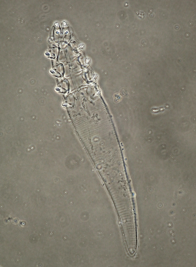 Demodex bialoviensis 